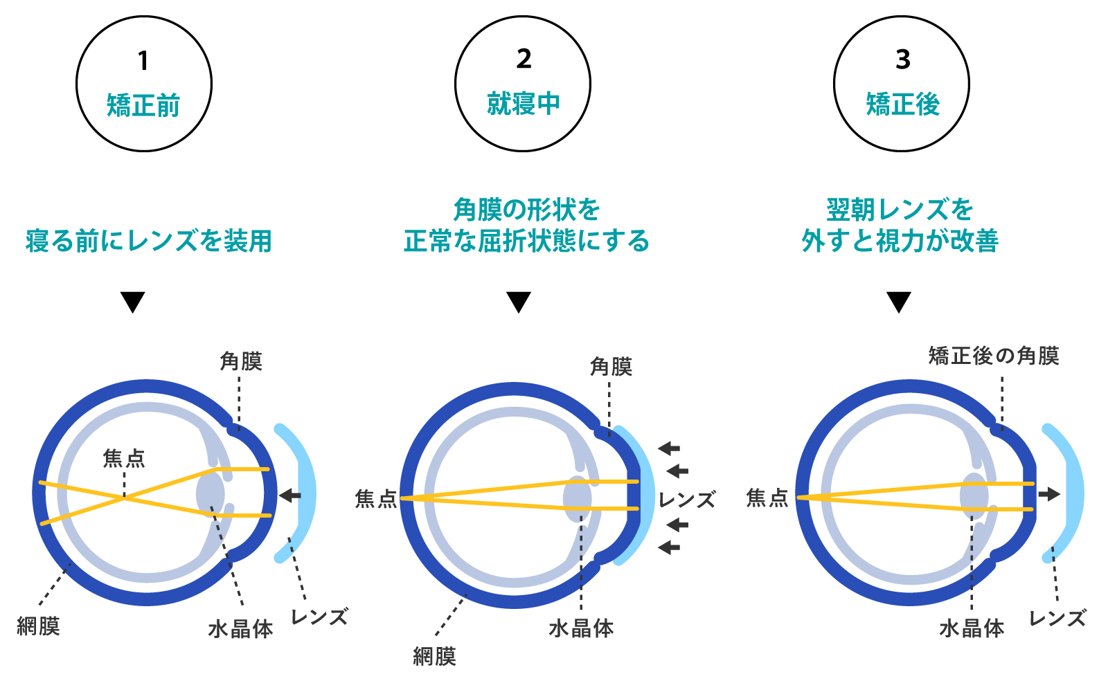 レンズ装着前、装着中、装着後